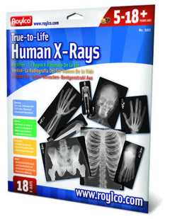 True To Life Human X-Rays - 18 pc